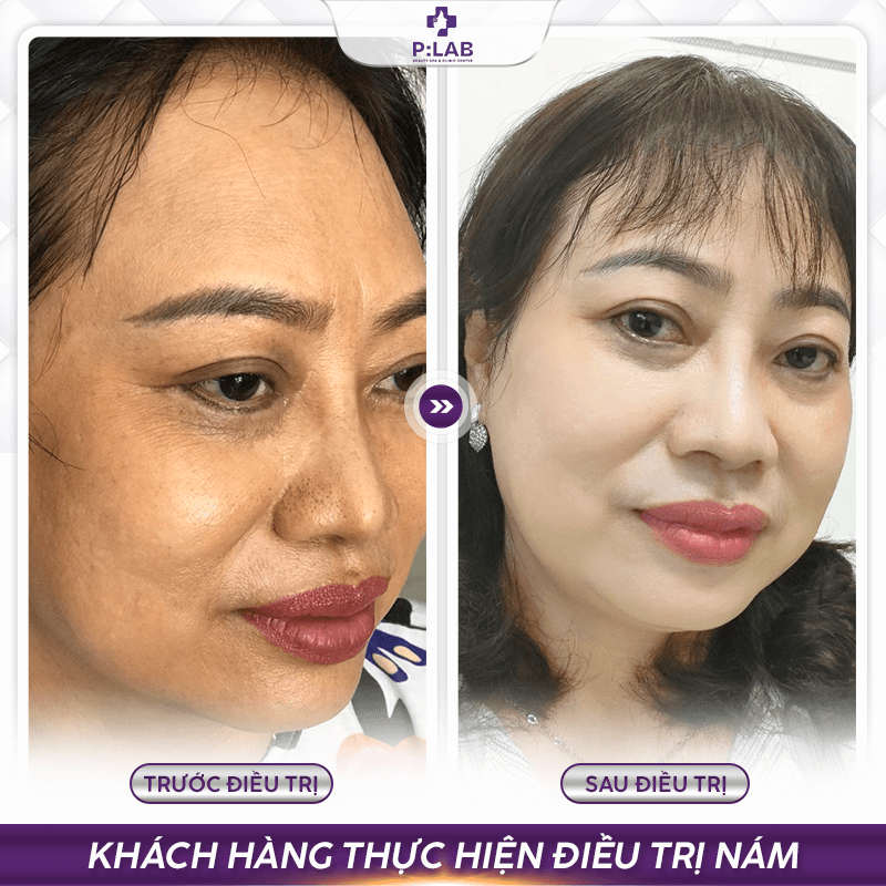 Plab-website (feedback) KH10