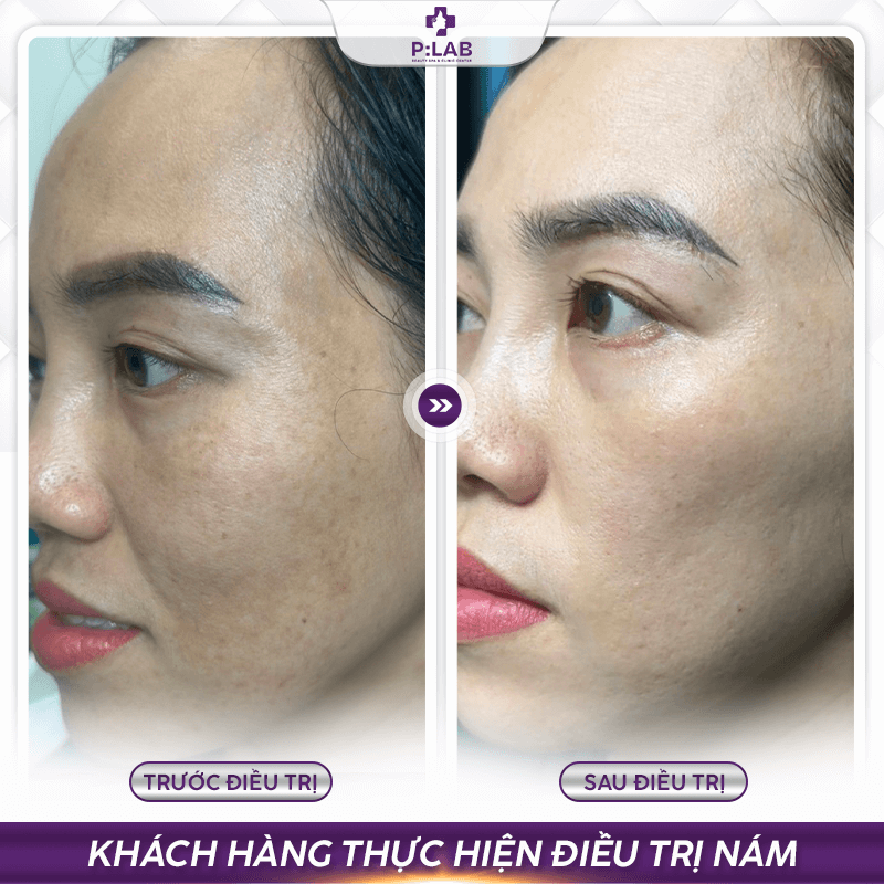 Plab-website (feedback) KH11 (1)