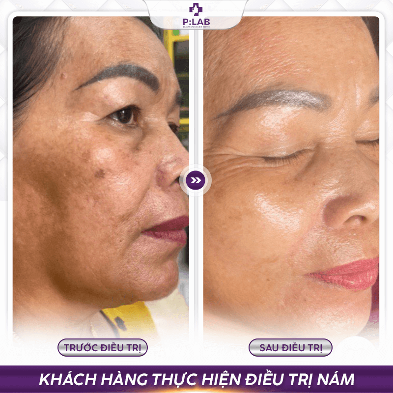 Plab-website (feedback) KH12