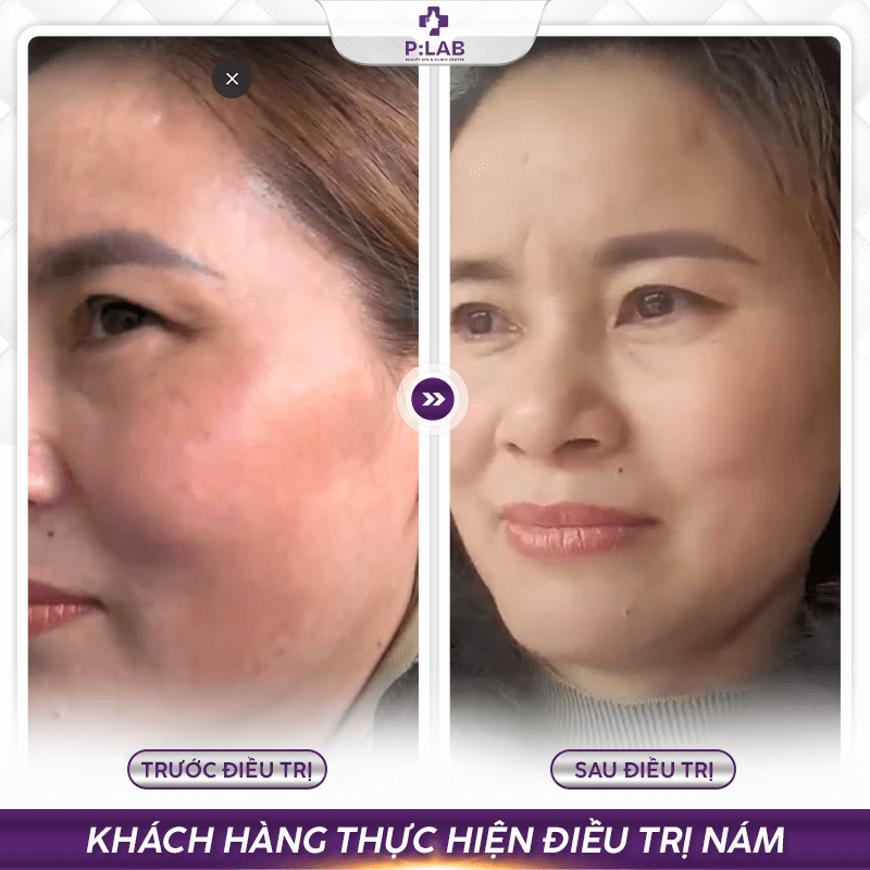 Plab-website (feedback) KH14