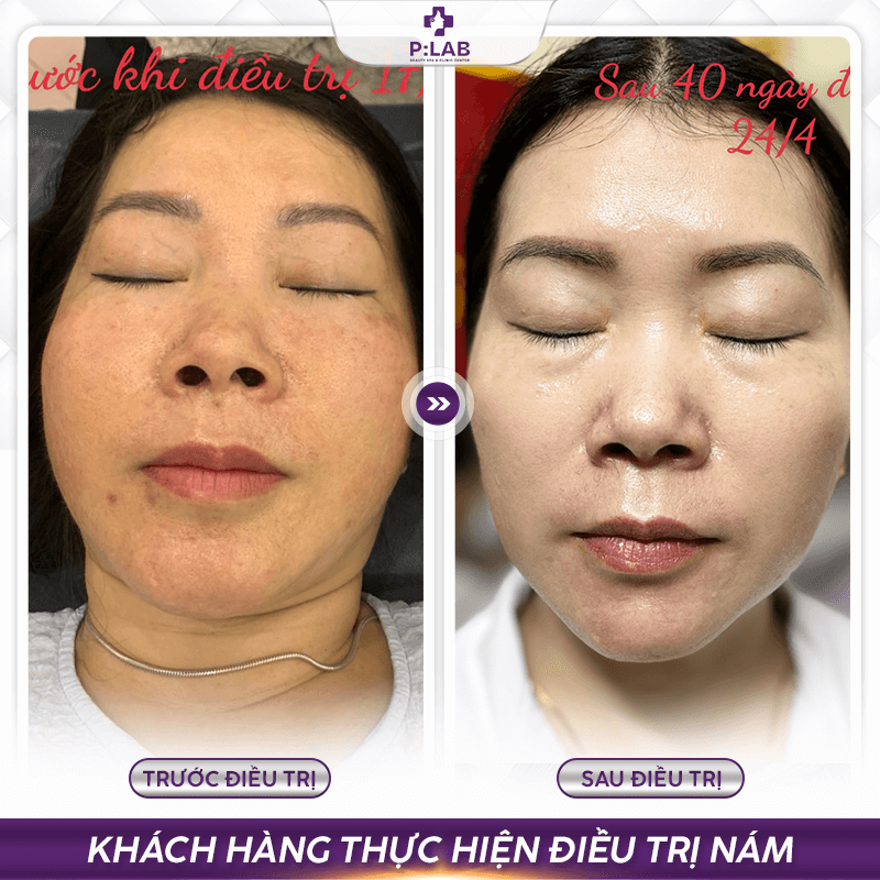 Plab-website (feedback) KH17