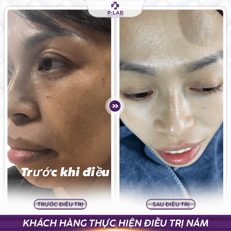 Plab-website (feedback) KH19