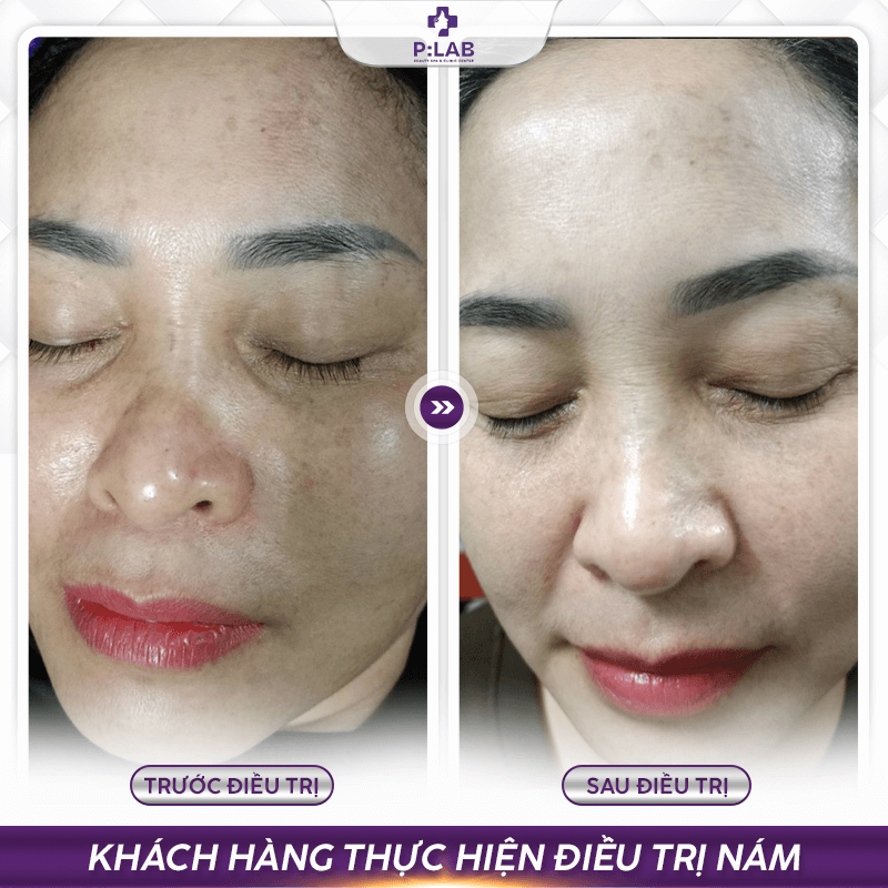 Plab-website (feedback) KH21