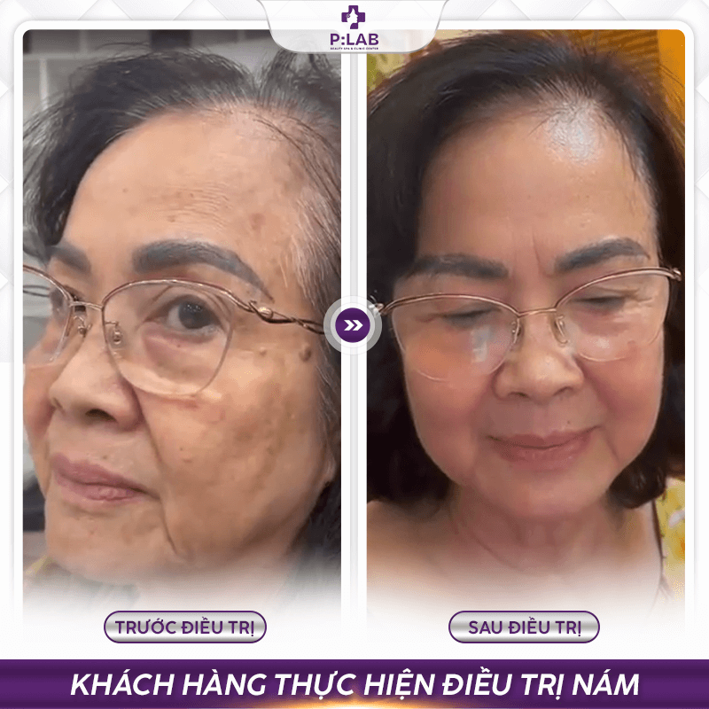 Plab-website (feedback) KH22