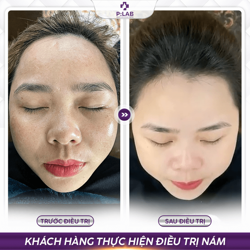 Plab-website (feedback) KH24