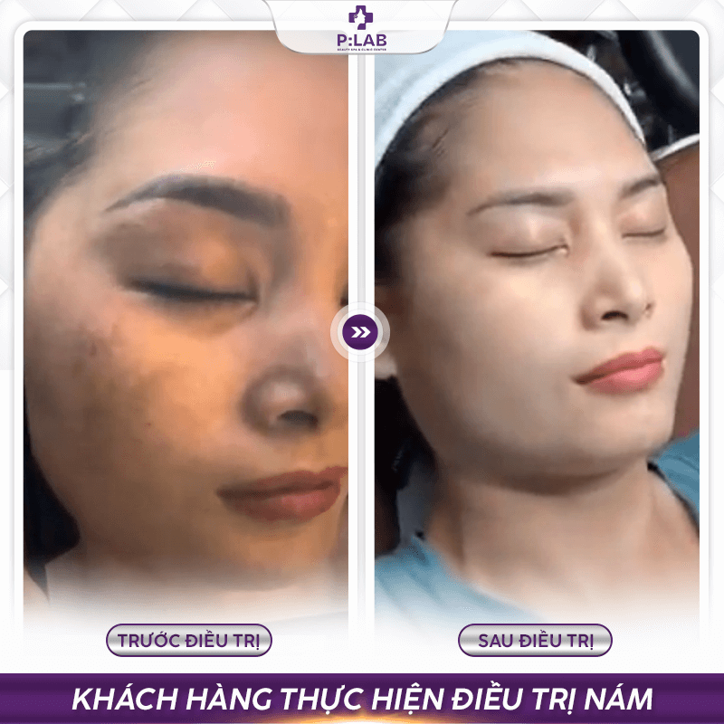 Plab-website (feedback) KH28