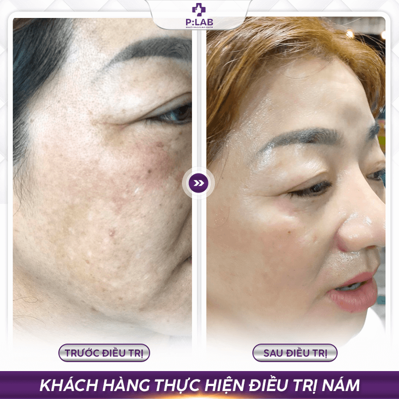 Plab-website (feedback) KH32