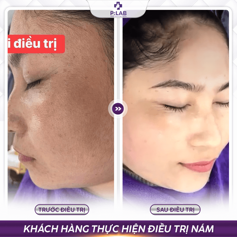 Plab-website (feedback) KH33