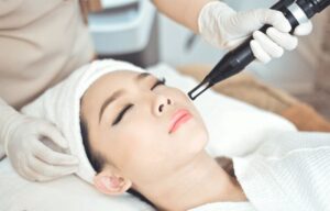 Trị Nám Bằng Laser