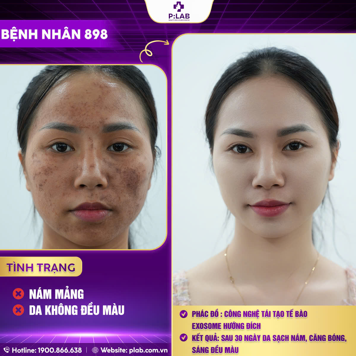 z5701204416858_06a9e580348311d0222c0a8c52ca4019