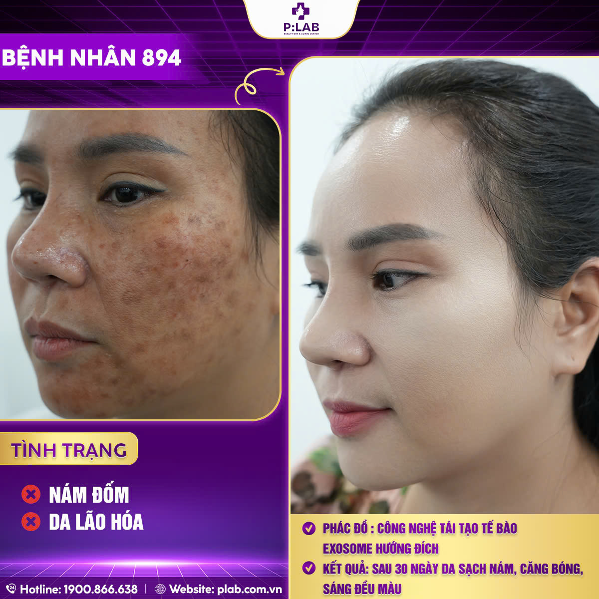 z5701204451639_8772aa2b1273d492e27e1b7130b704d0