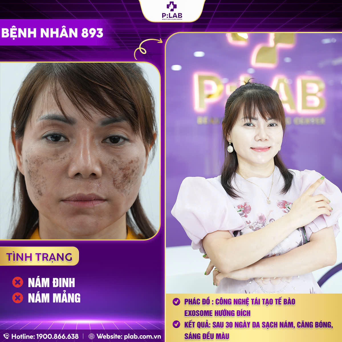 z5701204465393_9fedb758eb3aae10232c829acaba6b63